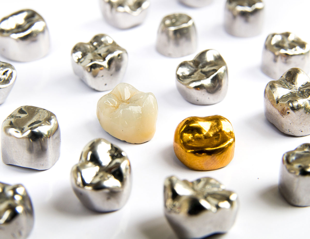 Los Altos Cosmetic Dentist